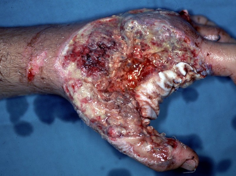 10 Scariest Diseases In The World - Elite Facts